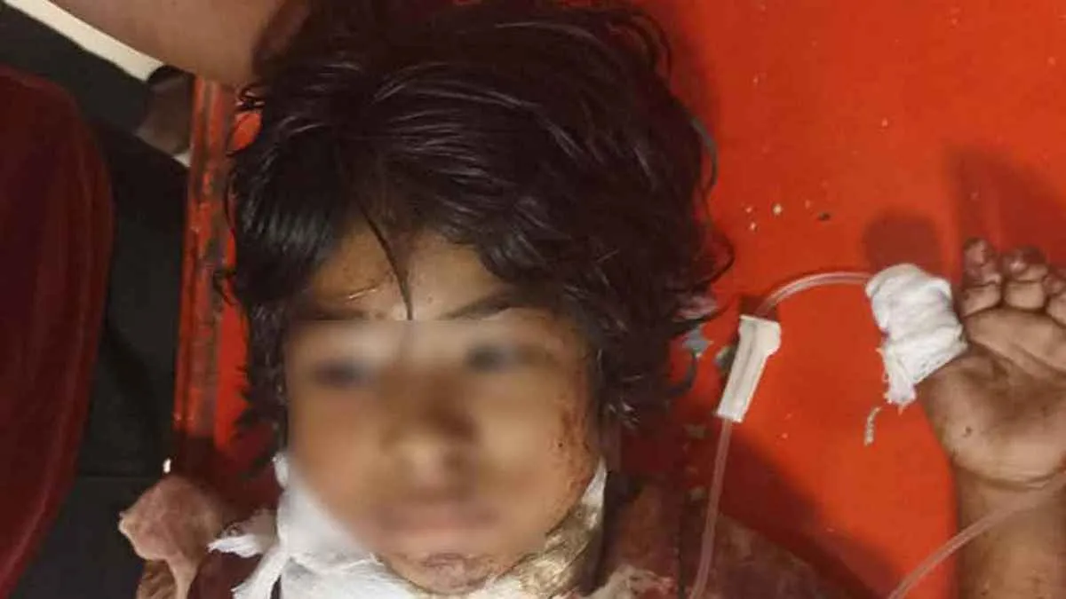 ইকোপার্ক থেকে গলাকাটা অবস্থায় উদ্ধার করা সেই শিশুটি মারা গেছে