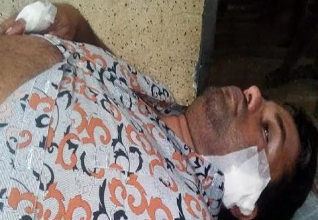 মহাখালীতে সজীব নামের ঠিকাদারকে প্রকাশ্যে গুলি 