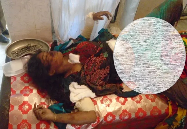 প্রতিপক্ষকে ফাঁসাতে ভাবিকে কুপিয়ে হত্যা চেষ্টা !