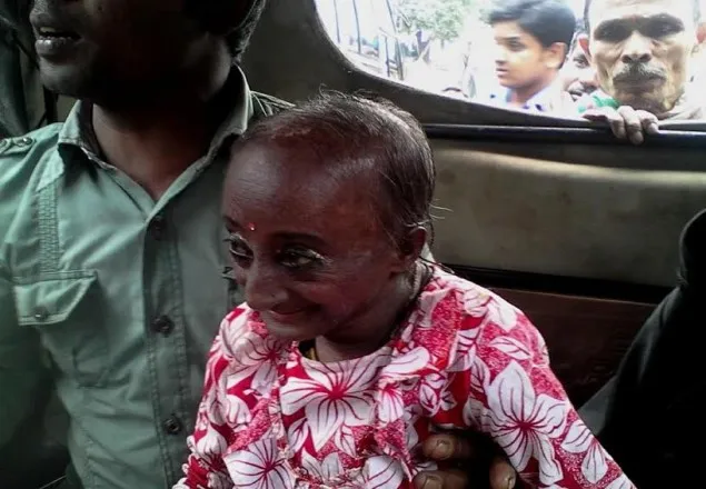 গাইবান্ধায় পাওয়া গেল ৩৫ ইঞ্চি উচ্চতার নারী