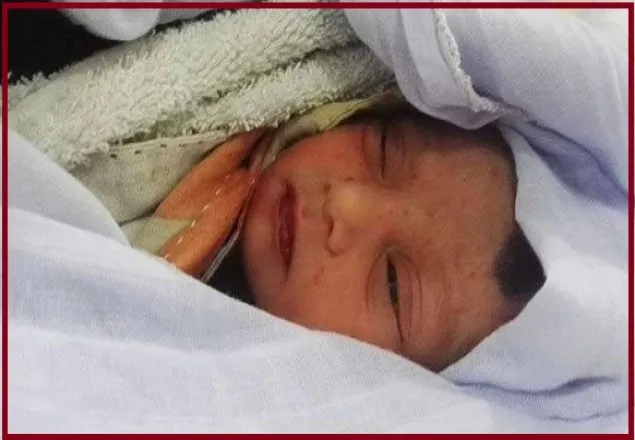 রাজধানীর বেড়িবাঁধে আবর্জনার স্তূপ থেকে জীবিত নবজাতক উদ্ধার 