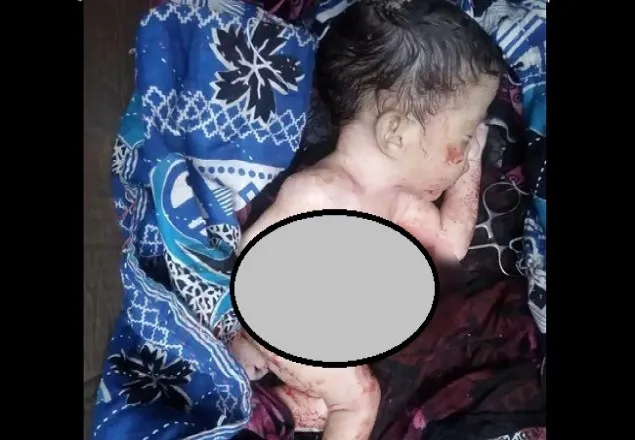 সিজার: ডাক্তারের ভুলে নাড়ি-ভুঁড়ি ও কলিজা বের হলো নবজাতকের!