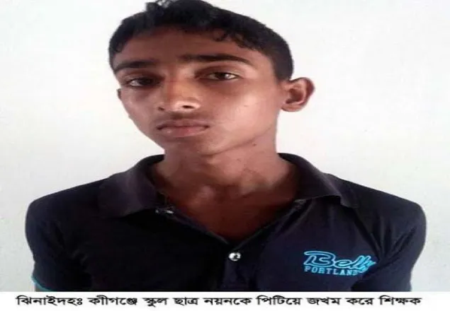 ঝিনাইদহে স্কুল ছাত্রকে পিটিয়ে হাসপাতালে, শিক্ষক বরখাস্ত