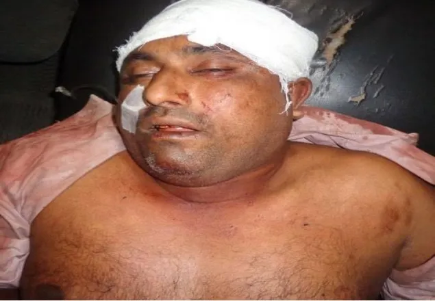 শৈলকুপায় খেলা নিয়ে সংঘর্ষে নিহত ১, গ্রেফতার ১৪