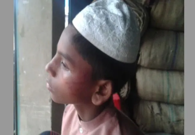  আম কুড়াতে যাওয়া কিশোরকে নির্যাতন!