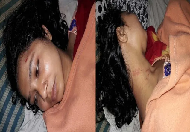 লালমনিরহাটে যৌতুকের জন্য কলেজ পড়ুয়া গৃহবধূকে নির্যাতন