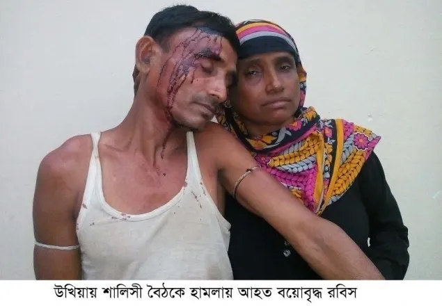 উখিয়ায় সালিশ বৈঠকে দিন মজুরের উপর হামলা