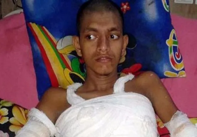 পল্লী বিদ্যুতের অবহেলায় হাত কাটা পড়ল মেধাবী ছাত্রের