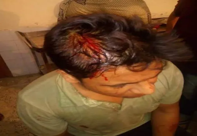 পবিপ্রবিতে ছাত্রলীগের হামলায় সাংবাদিকসহ ১০ শিক্ষার্থী আহত