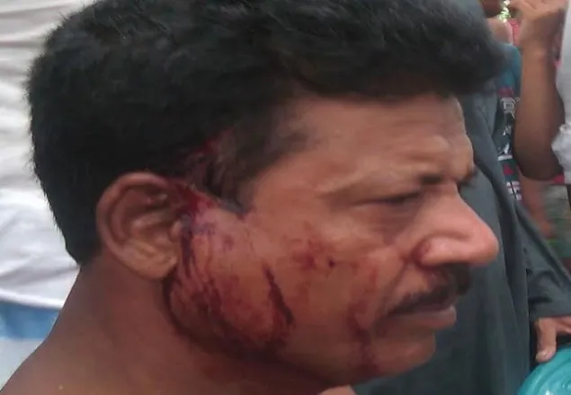 মাদক ব্যবসায়ীকে ধরতে গিয়ে দুই পুলিশ সদস্য গণধোলাইয়ের শিকার