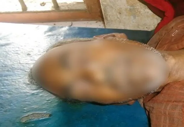 ডিমলায় জমি নিয়ে সংঘর্ষে শ্রমিক নিহত