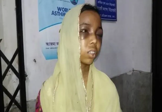 কর্নেলের ’স্ত্রী’র হাতে গৃহকর্মী নির্যাতিত, সিএমএইচে ভর্তি; মামলা দায়ের