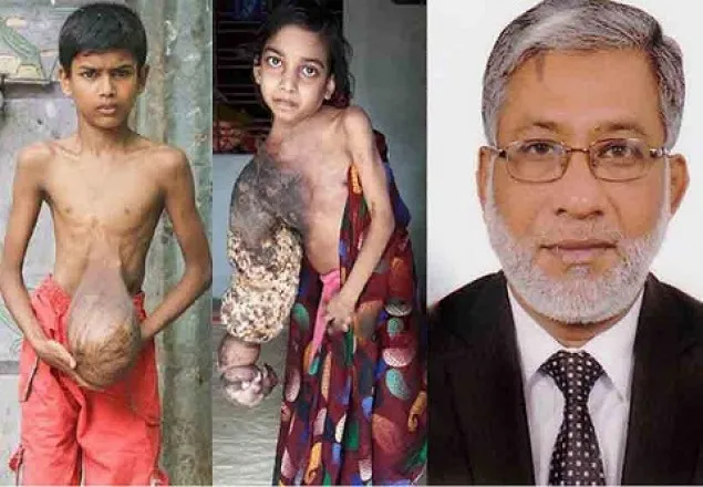 মুক্তা ও সবুজের চিকিৎসার দায়িত্ব নিলেন স্বাস্থ্য সচিব