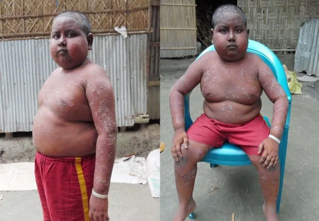 ভাগ্যের দিকে তাকিয়ে আছে অজানা রোগে আক্রান্ত মিরাজ