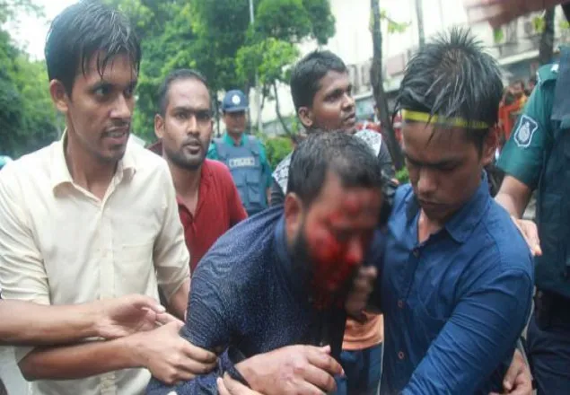'শেলের' আঘাতে আহত সিদ্দিকুরের চোখের আলো ফেরার সম্ভাবনা কম