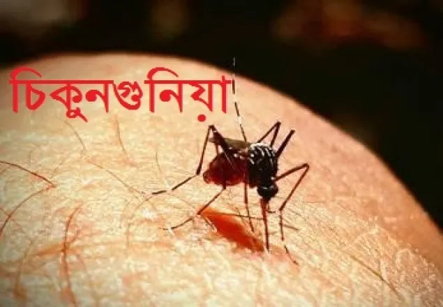 চিকুনগুনিয়ায় আক্রান্তদের ফিজিওথেরাপি কি নিরাপদ? 
