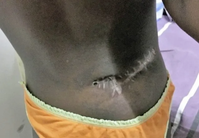 কঙ্গোয় গৃহযুদ্ধে ৬০ শিশুসহ নিহত ২৫০