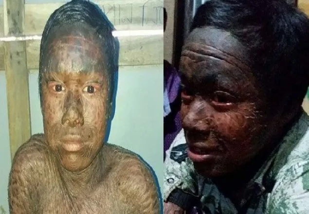 ‘বিরল রোগে’ আক্রান্ত শাহাদাতের বাঁচার আকুতি
