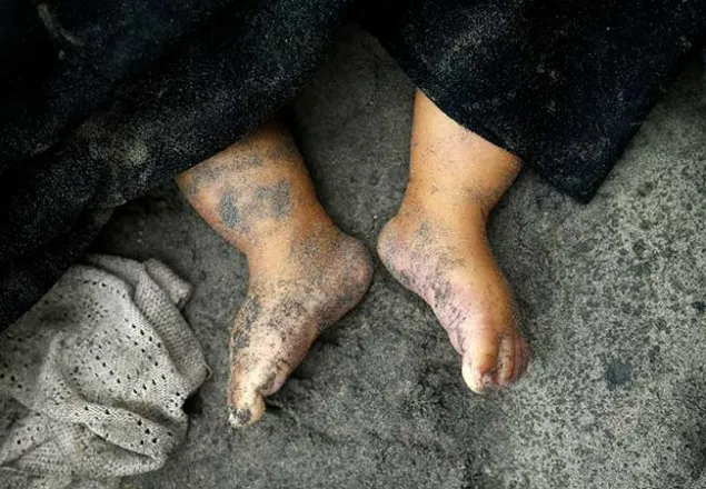 নাফ নদীতে এ পর্যন্ত ৪০ জনের লাশ উদ্ধার 