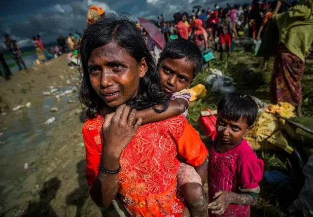 রোহিঙ্গা ক্যাম্পে প্রতি ৫ শিশুর ১ জন অপুষ্টির শিকার