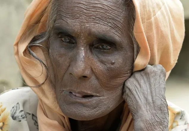 ২ লাখ রোহিঙ্গার দায়িত্ব নিবে তুরস্ক