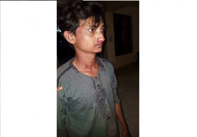 নোবিপ্রবিতে স্থানীয়দের সাথে শিক্ষার্থীদের সংঘর্ষ, আহত ৩