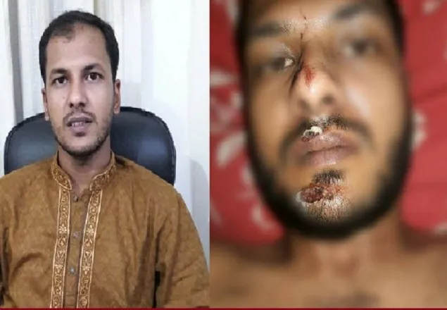 সড়ক দুর্ঘটনায় গুরুতর আহত ডা. সুমন 