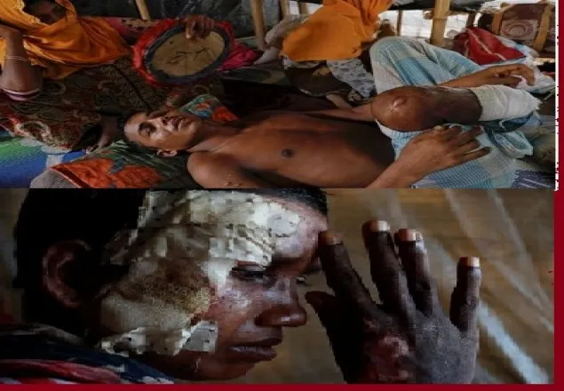 মিয়ানমারে কমপক্ষে ৬৭০০ রোহিঙ্গাকে হত্যা: এমএসএফ