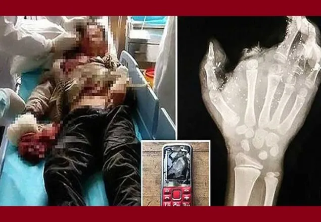 চীনা মোবাইল বিস্ফোরণে ‘আলো’ হারালো বালক