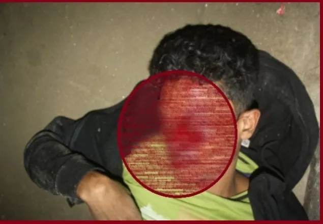 পুলিশের সোর্সের চোখ উপড়ে ফেললো দুর্বৃত্তরা 