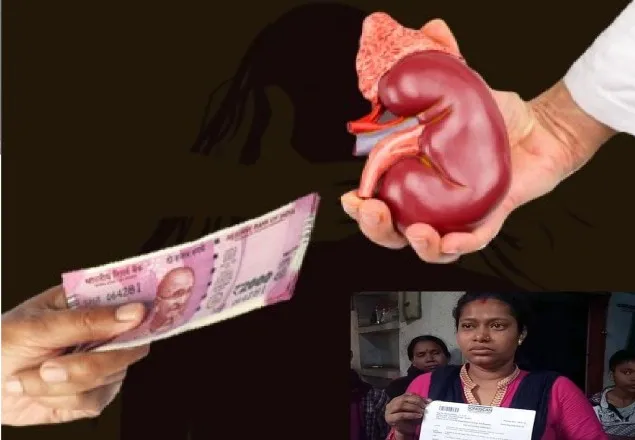 যৌতুকের টাকার জন্য স্ত্রীর কিডনি বিক্রি!