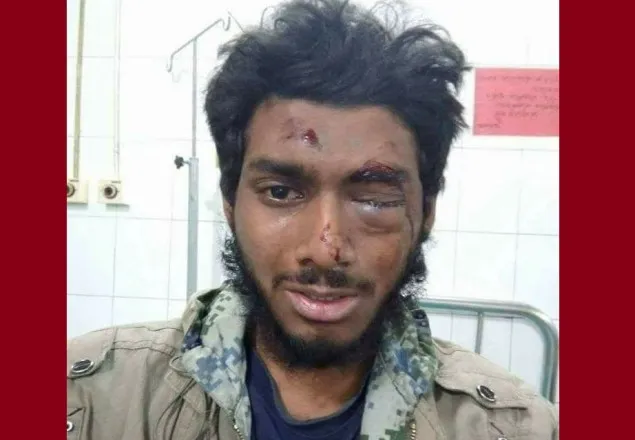 ছাত্রলীগের হামলায় আহত ঢাবি ছাত্রকে নেয়া হচ্ছে ভারতে     