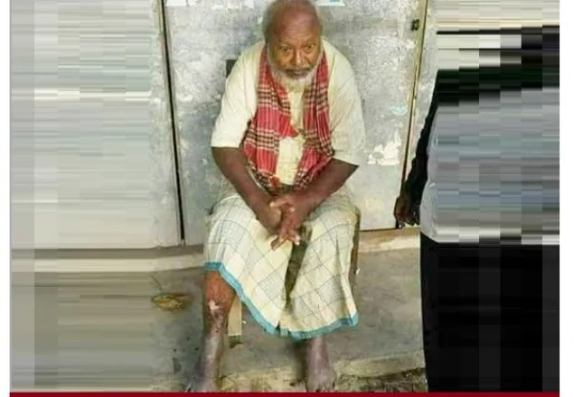 অবশেষে মারা গেছেন সেই আ’লীগ এমপি ইউসুফ   