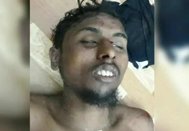 হামলাকারীকে গণধোলাইয়ের পর আটক