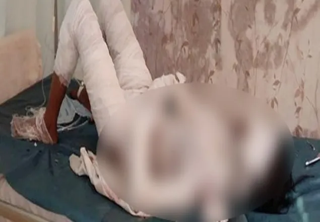 সিরাজগঞ্জে অন্তঃসত্ত্বা স্ত্রীকে গায়ে আগুন দিয়ে হত্যা
