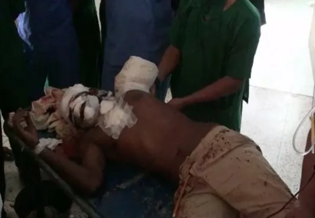 বাস-ট্রাকের সংঘর্ষে এবার বিচ্ছিন্ন হেলপারের হাত