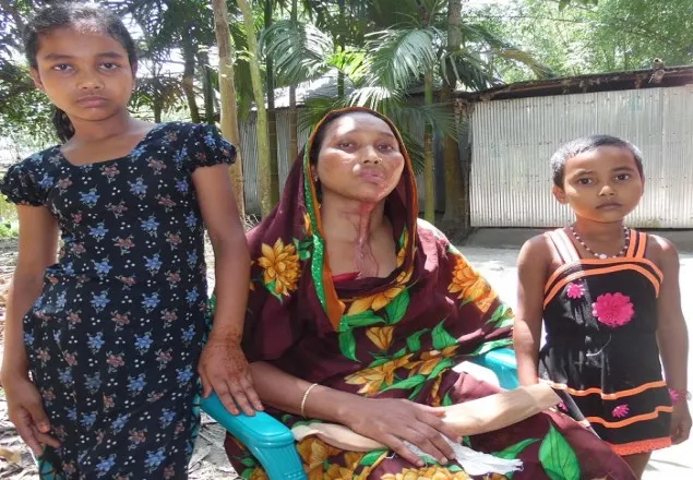 ৪ মাসেও গ্রেফতার হয়নি এসিড মামলার আসামী, এসিডদগ্ধ পরিবারকে হুমকি