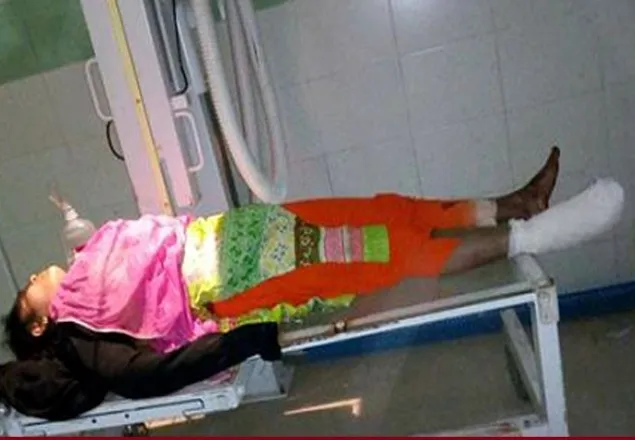 এবার মালিবাগে বাসের চাকায় পিষে গেল নারীর পা 
