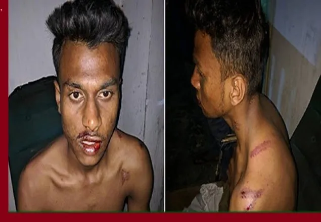 ঢাবি শিক্ষার্থী, রড দিয়ে পেটাল ছাত্রলীগ