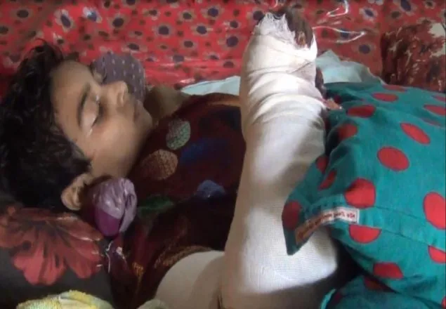 বিরল রোগে আক্রান্ত মুক্তামনি আর নেই