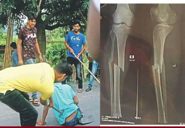 হাসপাতাল ছাড়তে হলো আহত তরিকুলকে 