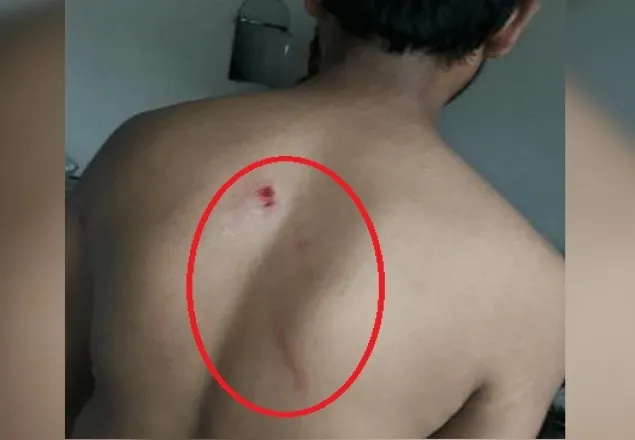 সিলেট সাংবাদিকের ওপর পুলিশ ও ছাত্রলীগের হামলা