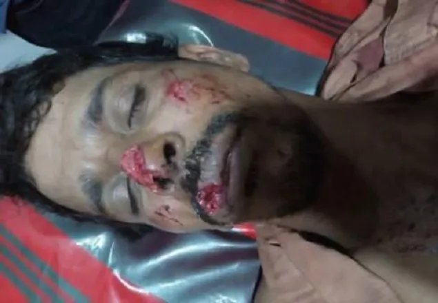 আকবরের উপর হামলাকারীদের গ্রেফতারের দাবি বাঙালি ছাত্রপরিষদের