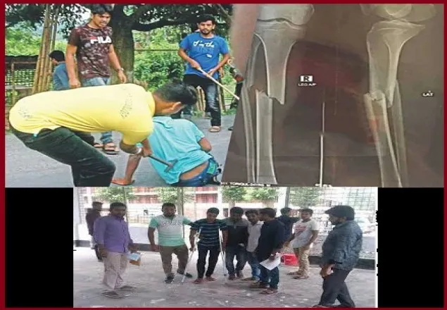 কোটা সংস্কার: ক্রাচে ভর দিয়ে পরীক্ষা দিলেন তরিকুল