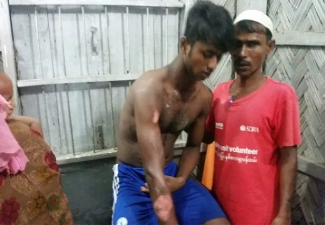 কক্সবাজারে গ্যাস সিলিন্ডার বিস্ফোরণে দগ্ধ ৩ রোহিঙ্গা