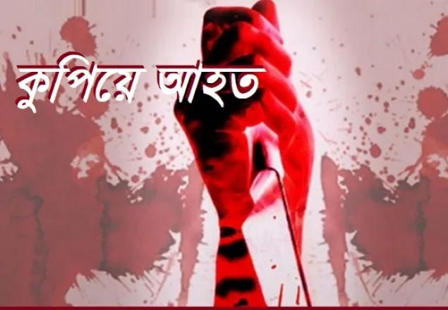 টঙ্গীতে জেএসসি পরীক্ষার্থীকে চাপাতি দিয়ে কুপিয়ে আহত 