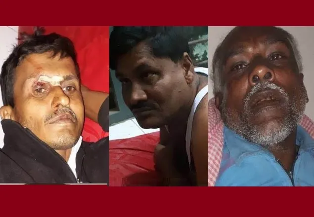 শার্শায় দুর্বৃত্তের বোমা হামলায় যুবলীগ নেতাসহ আহত ৩ 