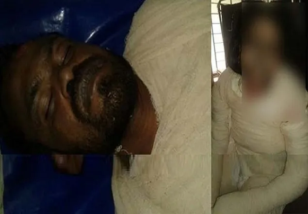 আশুলিয়ায় গ্যাস সিলিন্ডার বিস্ফোরণে দম্পতি দগ্ধ