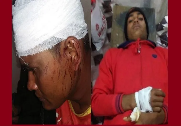 আ.লীগ-বিএনপি সংঘর্ষে পটুয়াখালীতে অর্ধশত আহত 