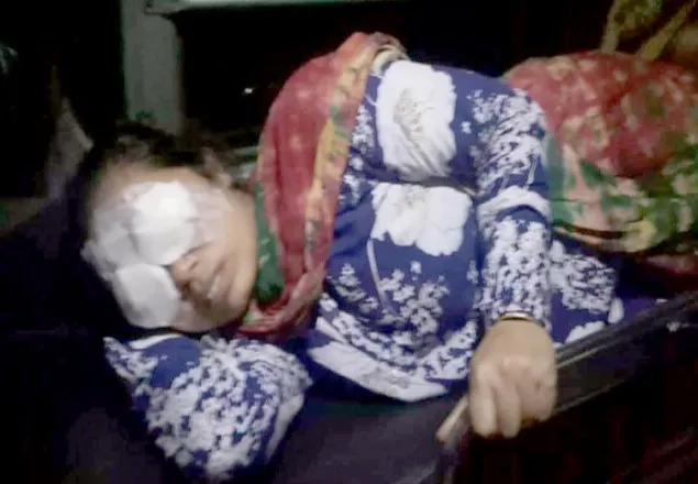 সিরাজগঞ্জে পুলিশ-বিএনপি সংঘর্ষে প্রার্থীসহ আহত ২০